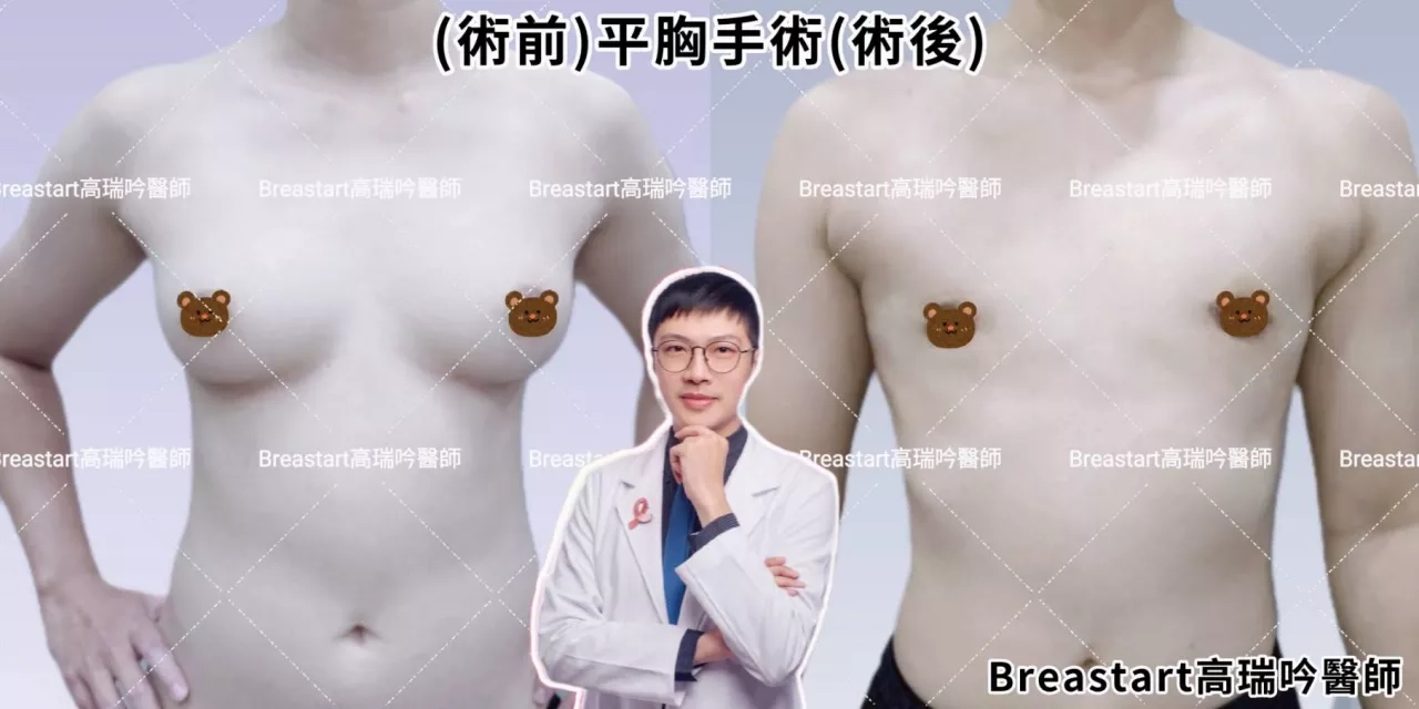 台南隆乳 高雄隆乳